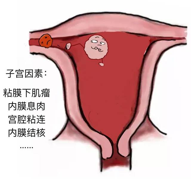 试管移植后吃阿司匹林肠溶片的原因是什么