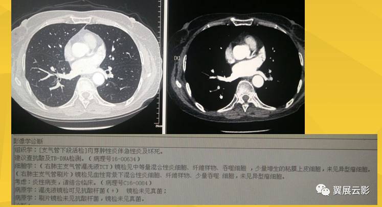 吉林长春市中医医院国内代生机构婴儿成功妊