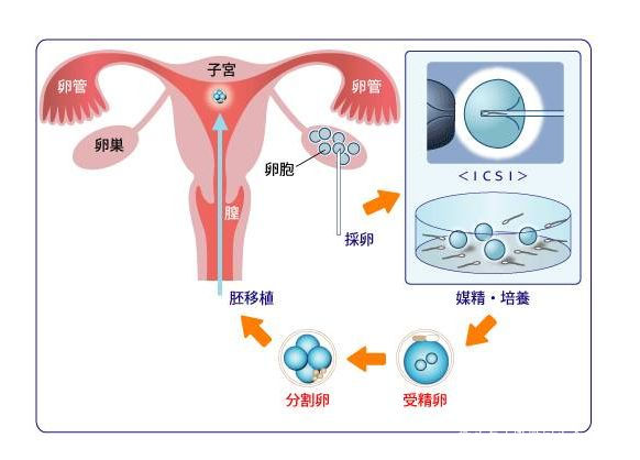 三代助孕选性别可以避免蚕豆病吗（蚕豆病可以代怀生子包男孩成功婴儿吗？）