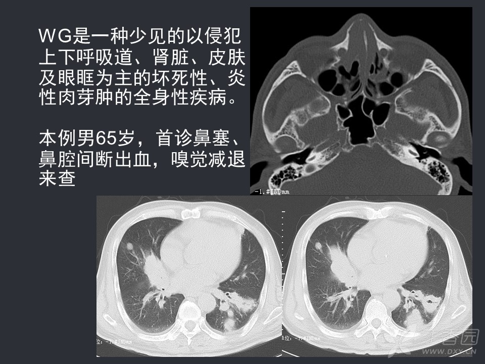 2024吉林做供精试管婴儿哪个医院助孕技术好