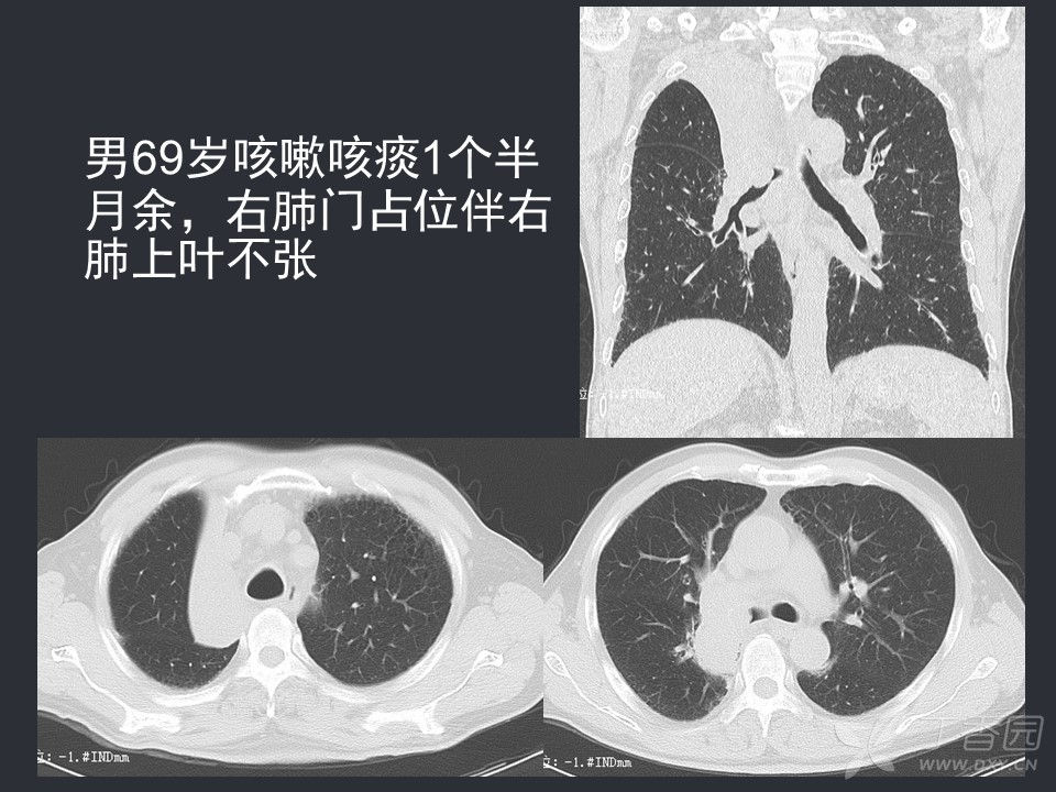 没有优势卵泡能去吉林助孕包性别代怀婴儿吗